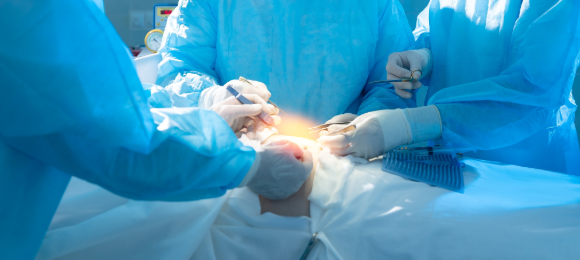 婦人科腹腔鏡下手術関連製品